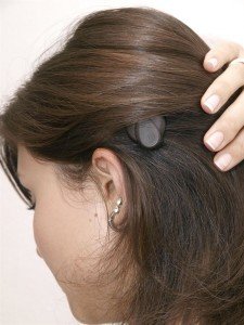 Implante coclear blog vidaes salud