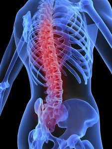 fisioterapia para combatir la osteoporosis vida es salud